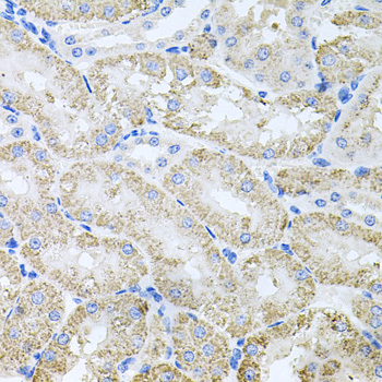 a03843 tars primary antiboties ihc testing 2