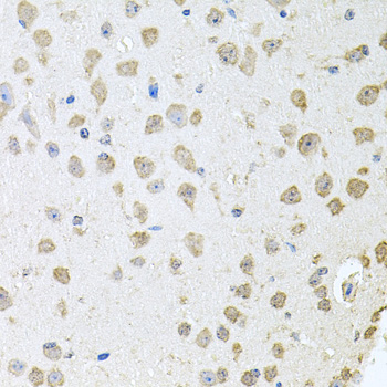 a03843 tars primary antiboties ihc testing 4