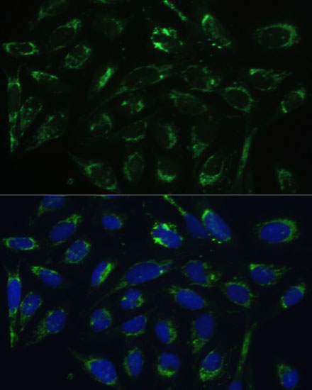 Immunofluorescence analysis of U-2 OS cells using ERAB/ERAB/HSD17B10 Polyclonal Antibody  at dilution of 1:100 