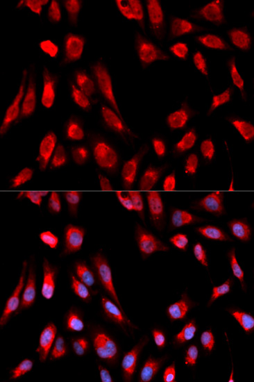 Immunohistochemistry of paraffin-embedded Human colon using ERAB/ERAB/HSD17B10 Rabbit pAb  at dilution of 1:100 