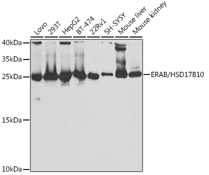 Western blot analysis of extracts of various cell lines, using ERAB/ERAB/HSD17B10 antibody  at 1:1000 dilution