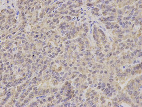 a03844 hsd17b10 primary antiboties wb testing 2