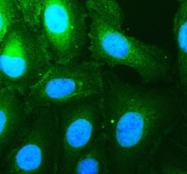 IF analysis of RAB35 using anti-RAB35 antibody (A03845-2)