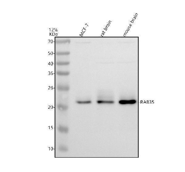Western blot analysis of RAB35 using anti-RAB35 antibody (A03845-2)