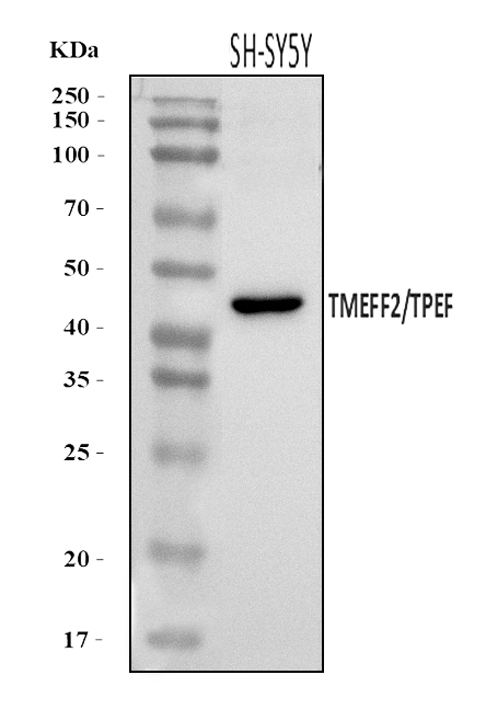  Western blot analysis of TMEFF2 using anti-TMEFF2 antibody (A03846-1)