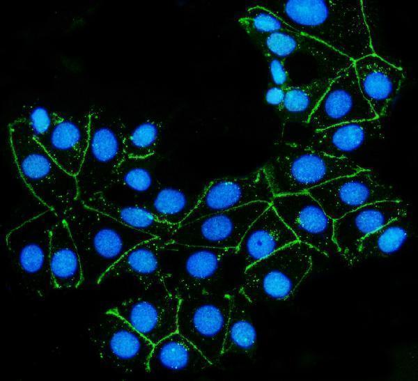 a03851 3 cldn 7 primary antibodies if testing 6