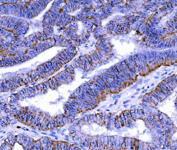 a03851 3 cldn 7 primary antibodies ihc testing 4