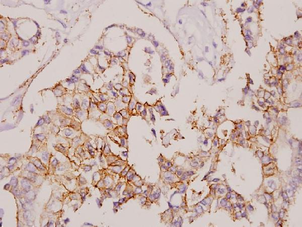 a03851s204 cldn7 primary antiboties ihc testing 2