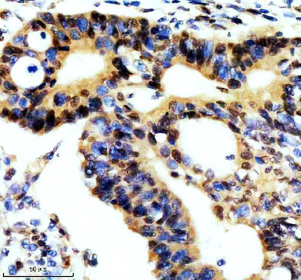 IHC analysis of REST using anti-REST antibody (A03852-3)