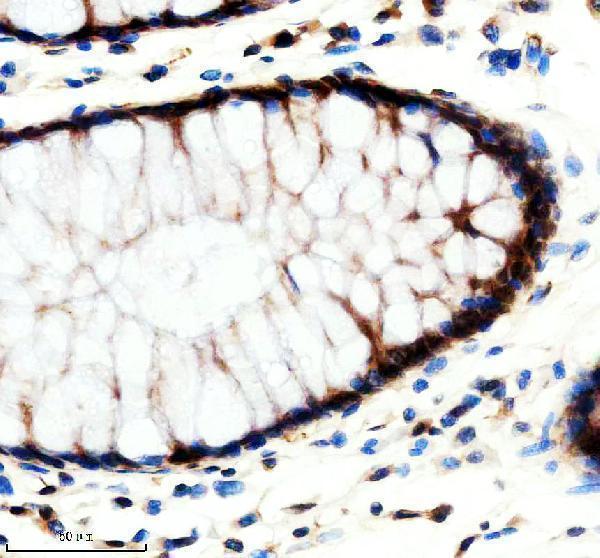 IHC analysis of REST using anti-REST antibody (A03852-3)
