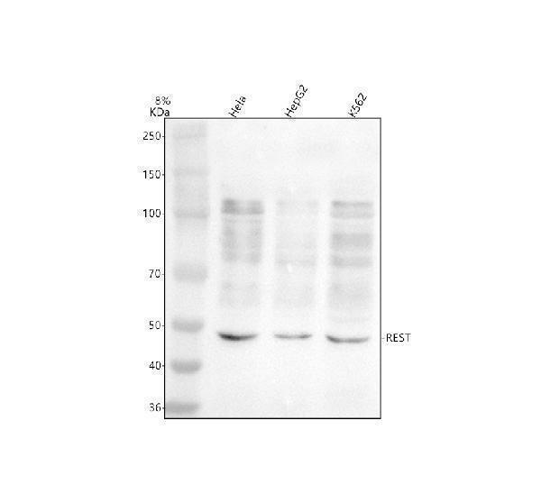 Western blot analysis of REST using anti-REST antibody (A03852-3)