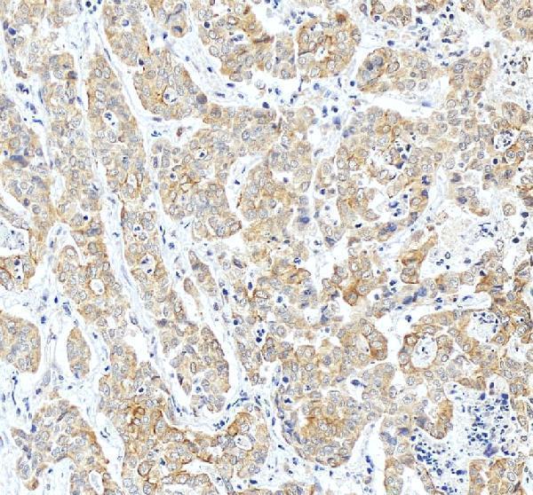 IHC analysis of Pyruvate Carboxylase/PC using anti-Pyruvate Carboxylase/PC antibody (A03853-2)