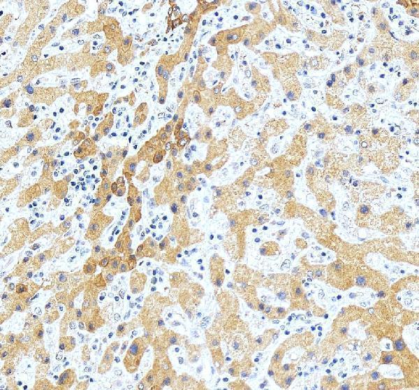 IHC analysis of Pyruvate Carboxylase/PC using anti-Pyruvate Carboxylase/PC antibody (A03853-2)