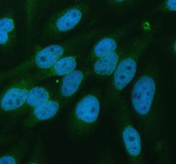 a03853 2 pyruvate carboxylase pc primary antibodies if testing 1