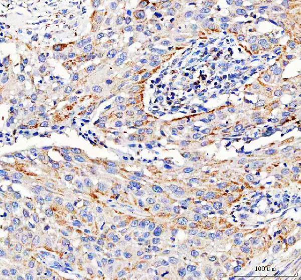 IHC analysis of Pyruvate Carboxylase/PC using anti-Pyruvate Carboxylase/PC antibody (A03853-3)
