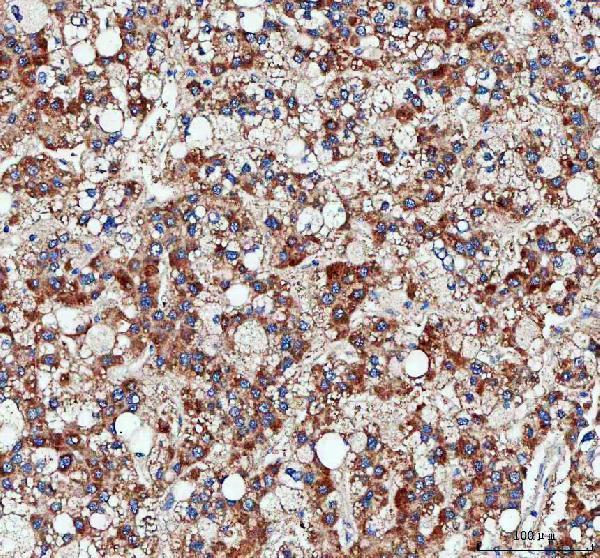  IHC analysis of Pyruvate Carboxylase/PC using anti-Pyruvate Carboxylase/PC antibody (A03853-3)