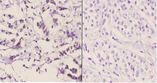 a03853 pc primary antiboties ihc testing 2