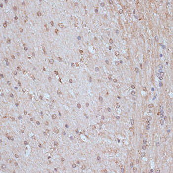 a03854 1 snw1 primary antiboties ihc testing 2