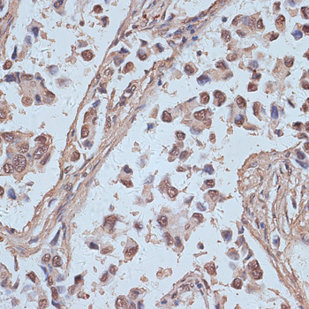 a03854 1 snw1 primary antiboties ihc testing 3
