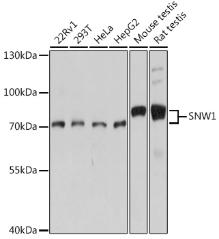 a03854 1 snw1 primary antiboties wb testing 1
