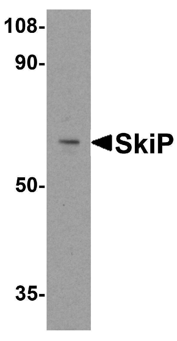 Western blot analysis of SkiP in mouse skeletal muscle tissue lysate with SkiP antibody at 0