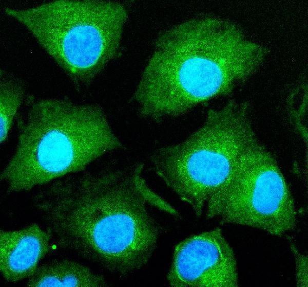 a03856 2 hjurp primary antibodies if testing 1