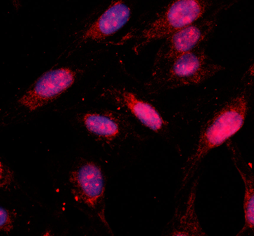 IF analysis of MED23 using anti-MED23 antibody (A03859-3)