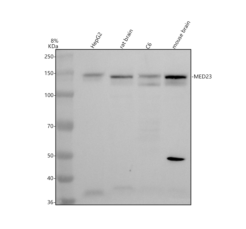 Western blot analysis of MED23 using anti-MED23 antibody (A03859-3)
