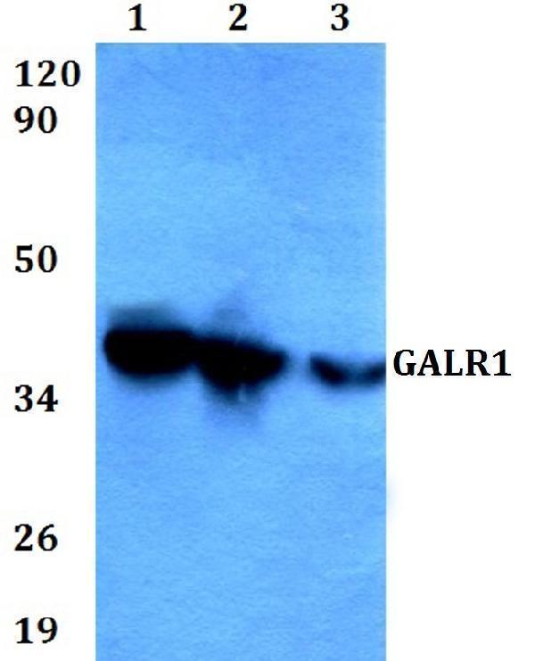 a03861 galr1 primary antiboties wb testing 1
