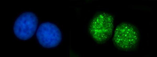  IF analysis of ATRIP using anti-ATRIP antibody (A03862-2)