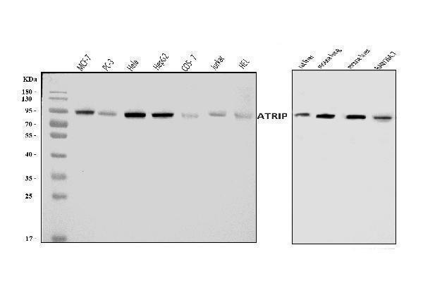  Western blot analysis of ATRIP using anti-ATRIP antibody (A03862-2)
