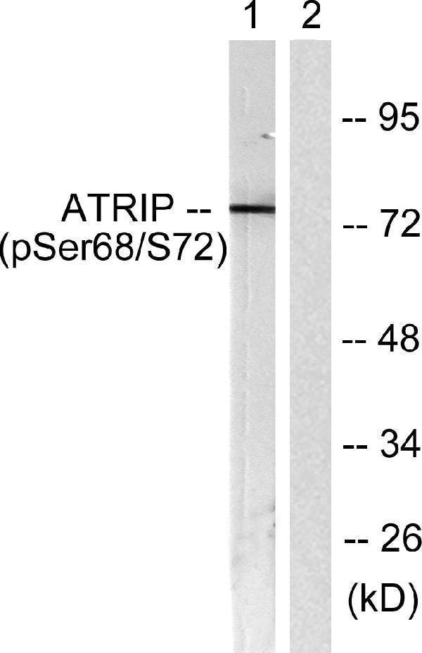 Western blot analysis of lysates from NIH/3T3 cells, using ATRIP (Phospho-Ser68) Antibody