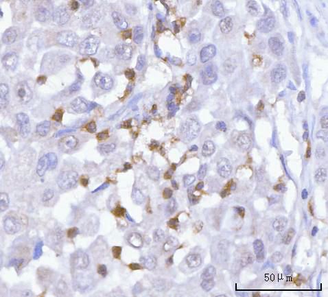  IHC analysis of PRTN3 using anti-PRTN3 antibody (A03863-3)