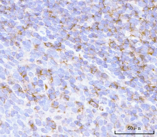 IHC analysis of PRTN3 using anti-PRTN3 antibody (A03863-3)