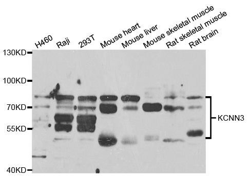 WesternBlot (WB) analysis of KCNN3 polyclonal antibody