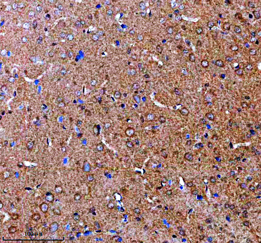 IHC analysis of KCNK9 using anti-KCNK9 antibody (A03867-2)