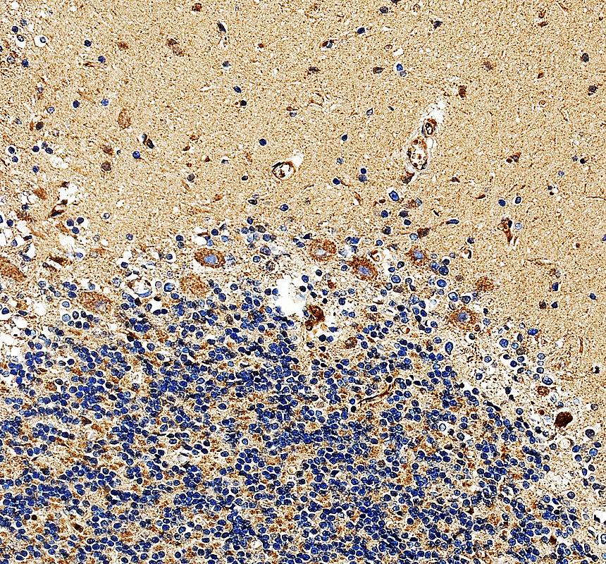 IHC analysis of KCNK9 using anti-KCNK9 antibody (A03867-2)