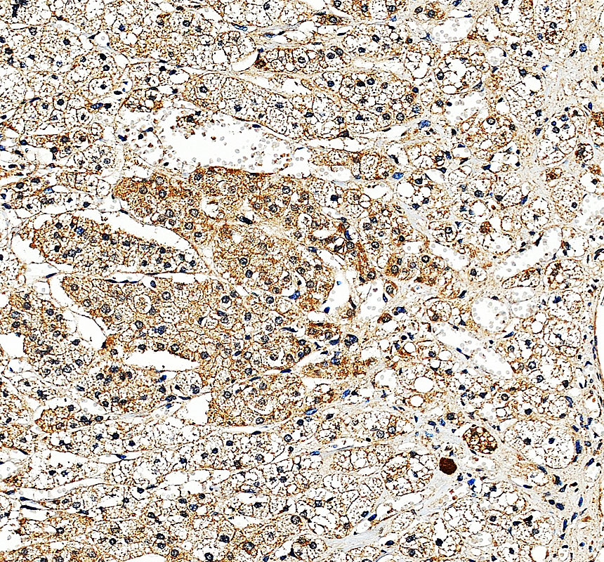 a03867 2 kcnk9 primary antibodies ihc testing 3