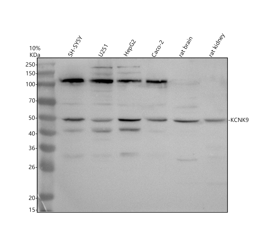Western blot analysis of KCNK9 using anti-KCNK9 antibody (A03867-2)