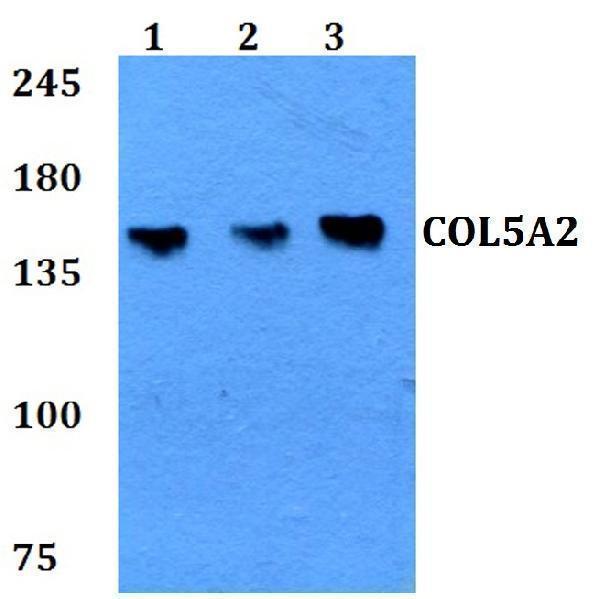 Western blot (WB) analysis of COL5A2 polyclonal antibody at 1:500 dilution
Lane1:HEK293T whole cell lysate
Lane2:Raw264