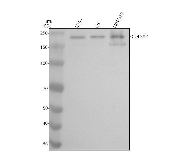 Western blot analysis of COL5A2 using anti-COL5A2 antibody (A03869-2)