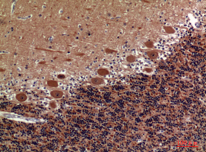 Immunohistochemical analysis of paraffin-embedded human-brain, antibody was diluted at 1:100
