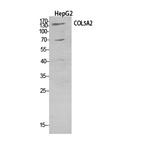 Western Blot analysis of HepG2 cells using COL5A2 Polyclonal Antibody