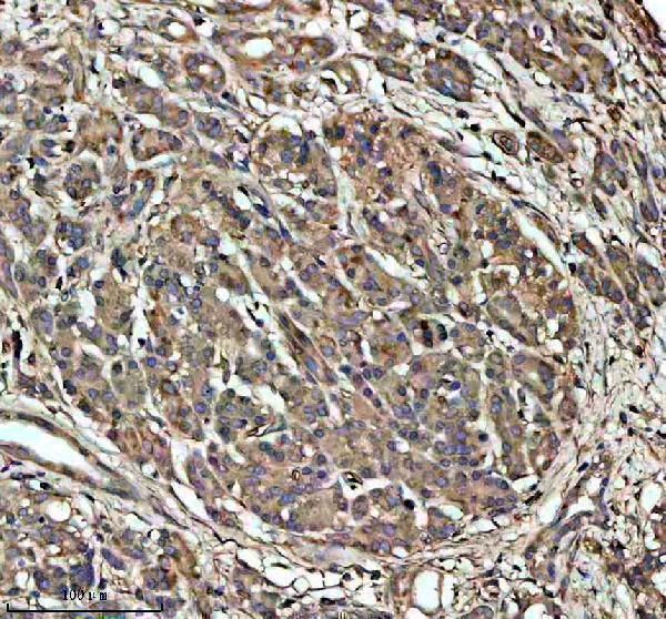 IHC analysis of Glypican 1/GPC1 using anti-Glypican 1/GPC1 antibody (A03871-2)