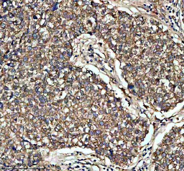 IHC analysis of Glypican 1/GPC1 using anti-Glypican 1/GPC1 antibody (A03871-2)
