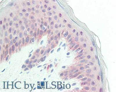 Immunohistochemistry of Rabbit anti-Glypican antibody