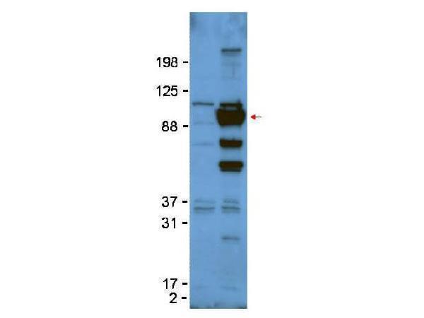 Western Blot of Rabbit anti-Glypican-1 antibody