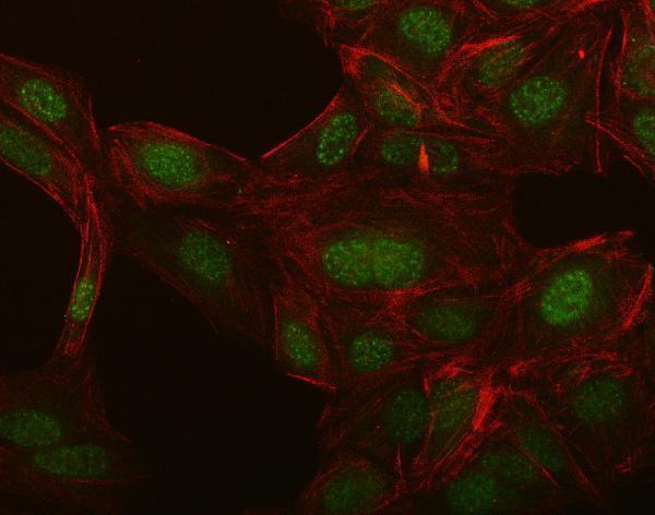 a03876 2 slc8a1 primary antibodies if testing 2