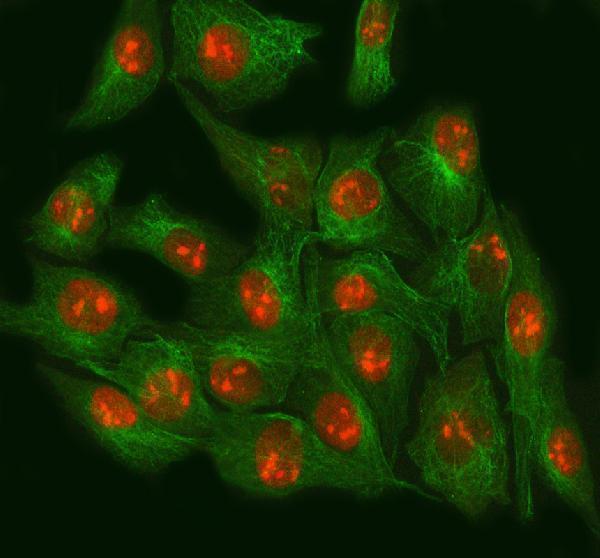 a03878 1 nsun2 primary antibodies if testing 10