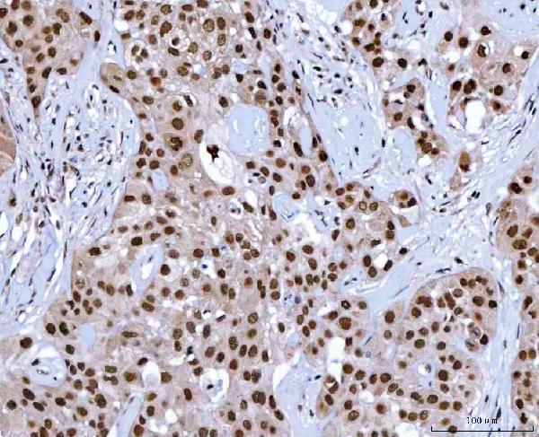  IHC analysis of NSUN2 using anti-NSUN2 antibody (A03878-1)